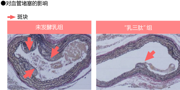 对血管堵塞的影响