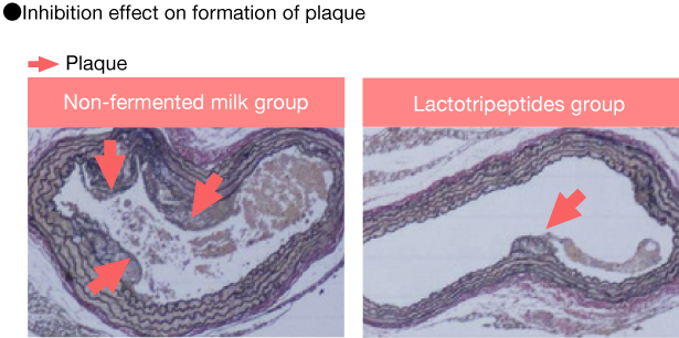 Inhibition effect on formation of plaque